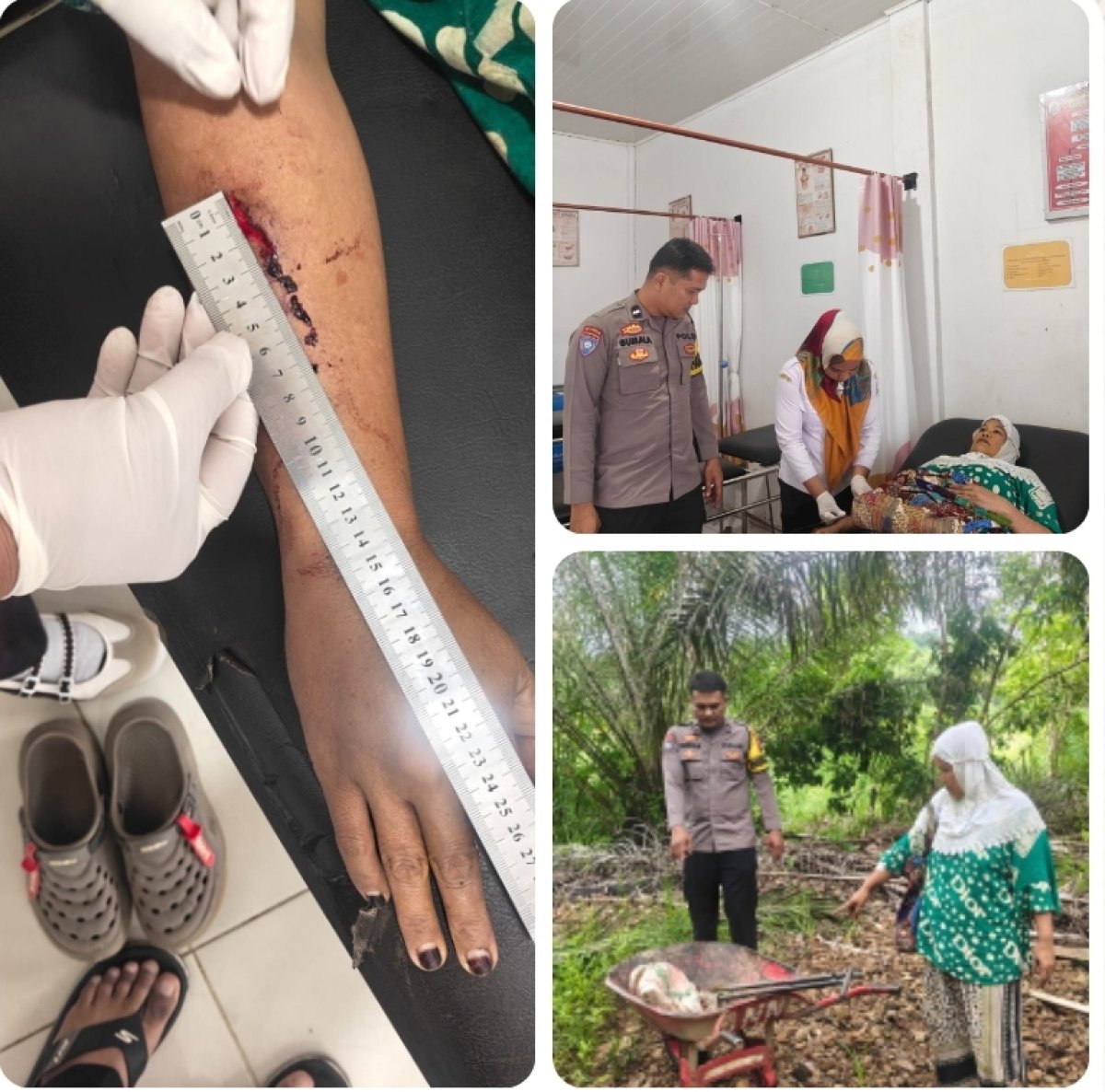 IRT Luka Robek Diduga Dianiaya Pencuri Buah Kelapa Sawit